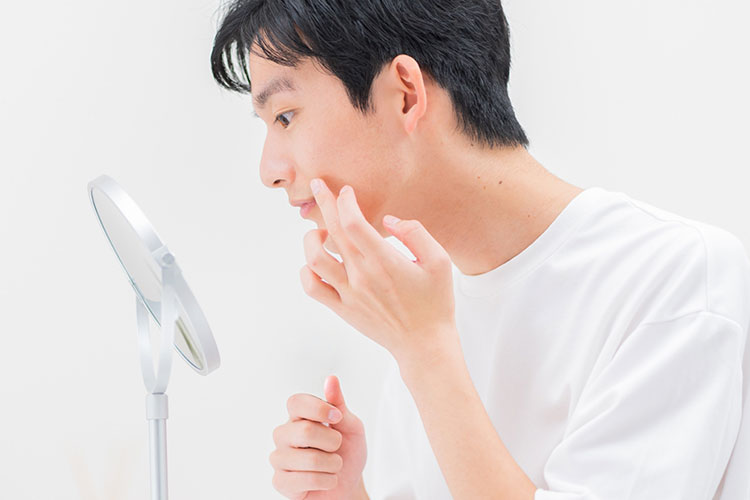 にきび.のイメージ写真