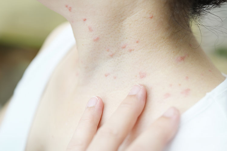 とびひ.のイメージ写真